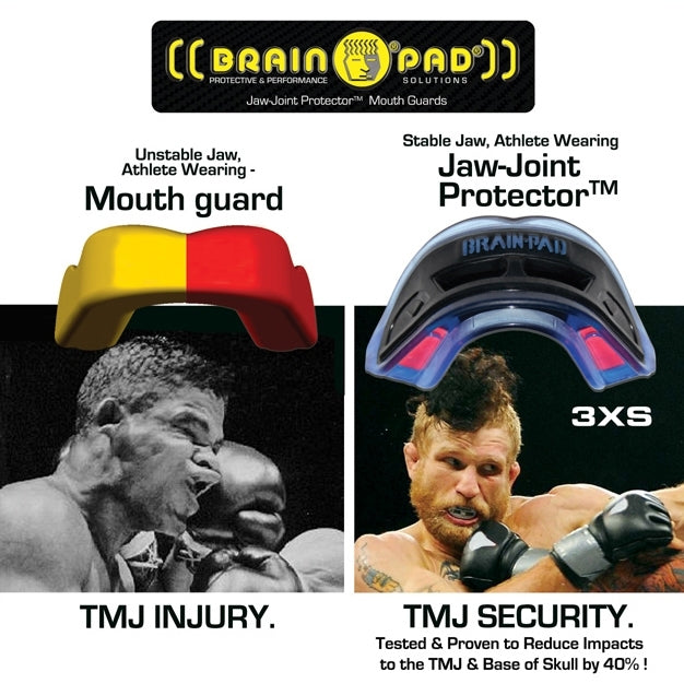 High Impact gel pad inserts Gel form liner molds firmly to teeth, supporting the entire arch Airflow clench and breath technology enhance breathing. 30-second custom fitting Latex Free The preferred mouth guard for high level contact sports